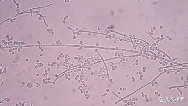 微生物菌肥中常见的12种菌剂介绍