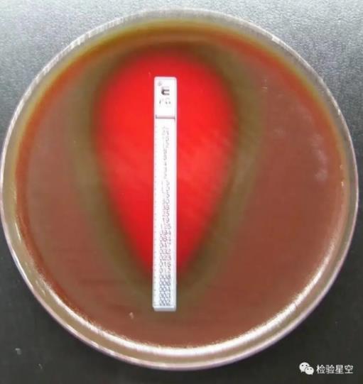 检验科微生物室细菌鉴定常见菌株形态特征、培养鉴别、临床表现及天然耐药