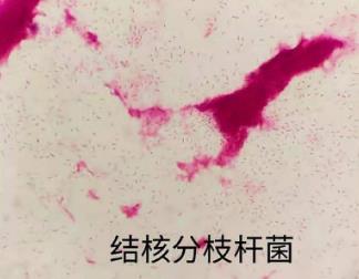 分枝杆菌在猫、狗、鸟中的流行和传播途径