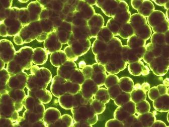 共生微生物调控TOR信号通路影响昆虫脂质代谢（三）