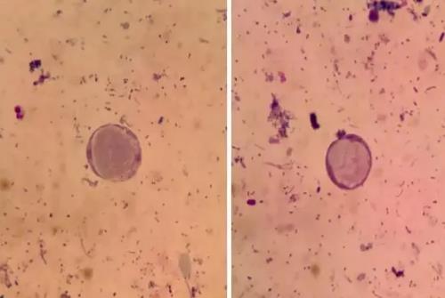 原虫分为哪四大类，原虫和蠕虫、异虫有什么区别