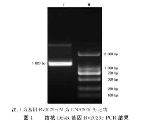 结核分枝杆菌蛋白Rv2029c促进大肠埃希菌生长及糖酵解能力——摘要、材料与方法