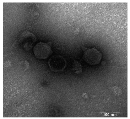 原生动物而非噬菌体主导对细菌的长期下行调控（二）