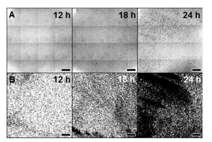 全自动微生物生长曲线分析仪应用：黄芩素与壳聚糖抑制酵母生物膜研究（一）