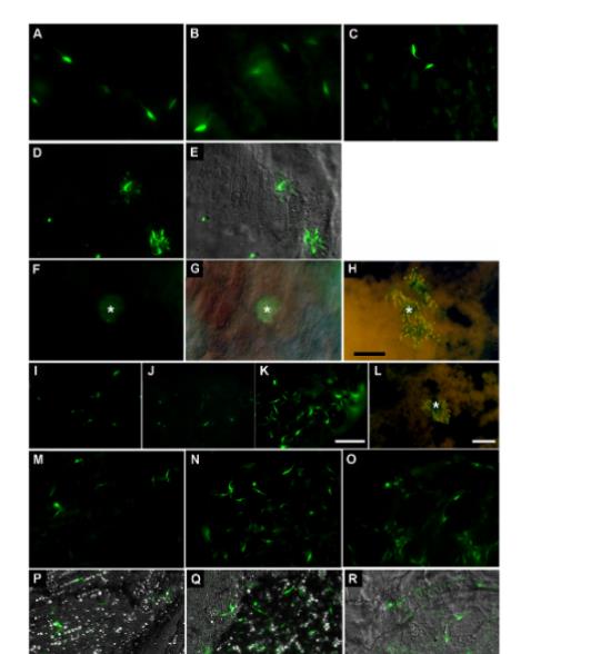 微生物生长曲线分析仪：克氏锥虫在媒介肠道内的定植策略与生存智慧（六）
