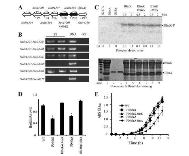 新发现BfmAK信号系统控制嗜麦芽寡养单胞菌生物膜形成（四）