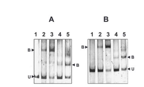 乳酸乳球菌新型转录因子HdiR响应热与DNA损伤的分子机制研究（五）